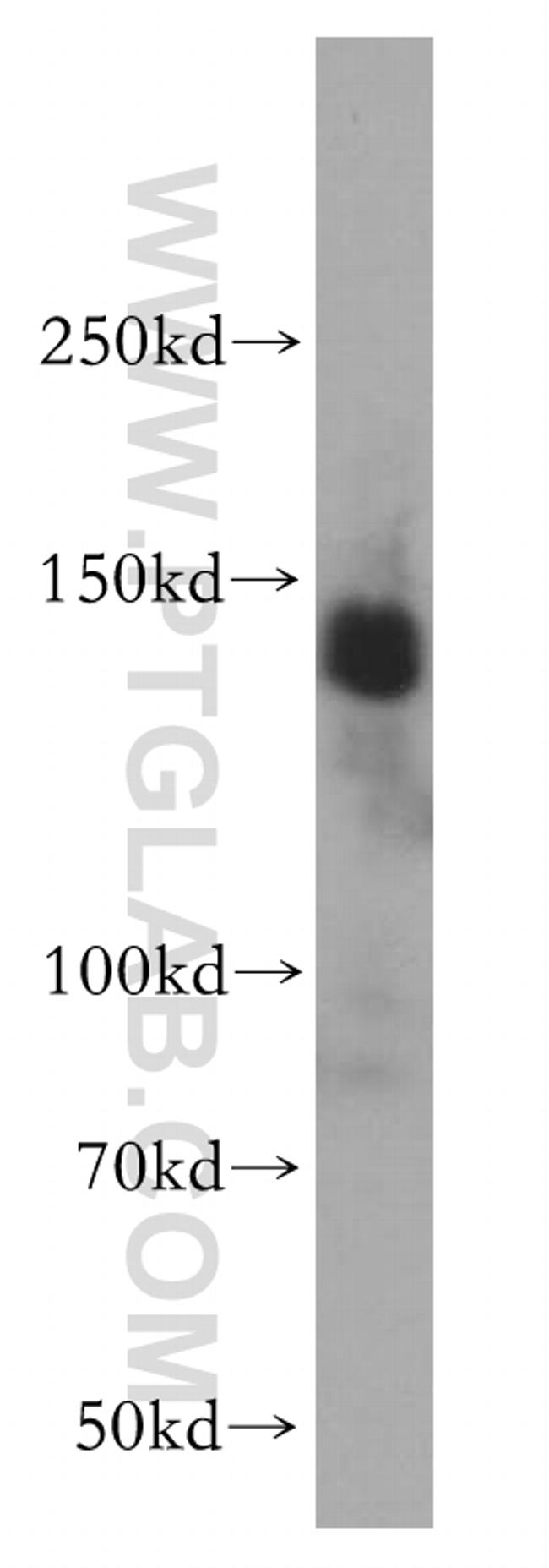 TFII I Antibody in Western Blot (WB)