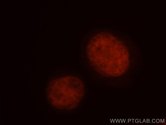 TFII I Antibody in Immunocytochemistry (ICC/IF)