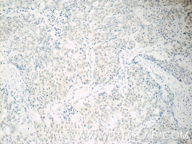 TFII I Antibody in Immunohistochemistry (Paraffin) (IHC (P))