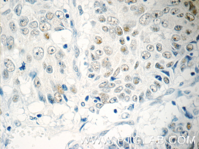 TFII I Antibody in Immunohistochemistry (Paraffin) (IHC (P))