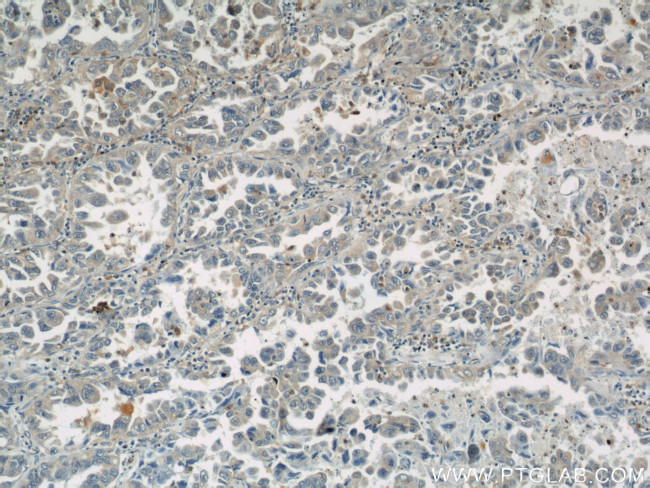 ASC/TMS1 Antibody in Immunohistochemistry (Paraffin) (IHC (P))