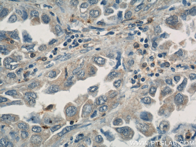 ASC/TMS1 Antibody in Immunohistochemistry (Paraffin) (IHC (P))