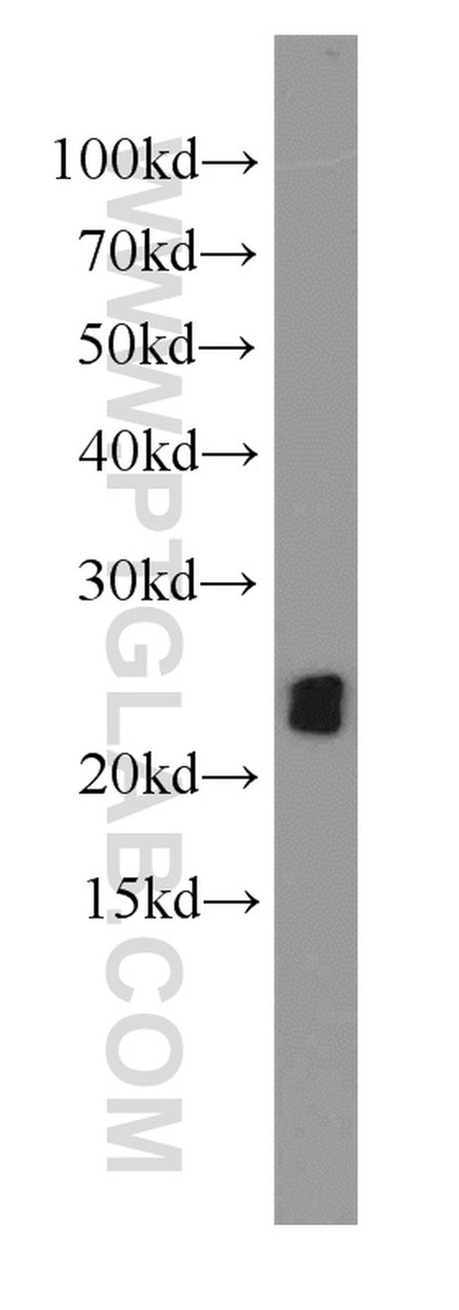 ASC/TMS1 Antibody in Western Blot (WB)