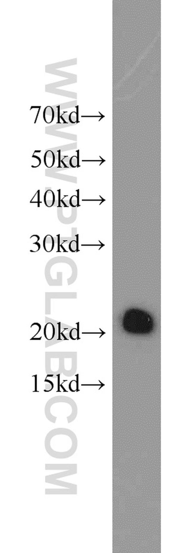 ASC/TMS1 Antibody in Western Blot (WB)