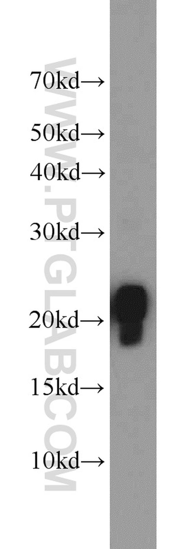 ASC/TMS1 Antibody in Western Blot (WB)