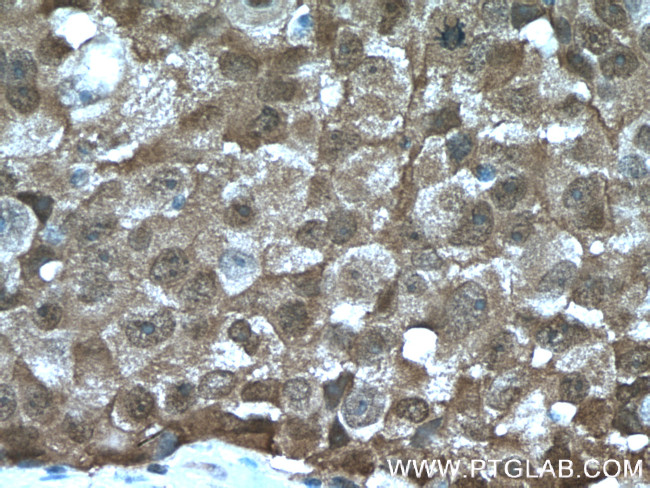 ASC/TMS1 Antibody in Immunohistochemistry (Paraffin) (IHC (P))