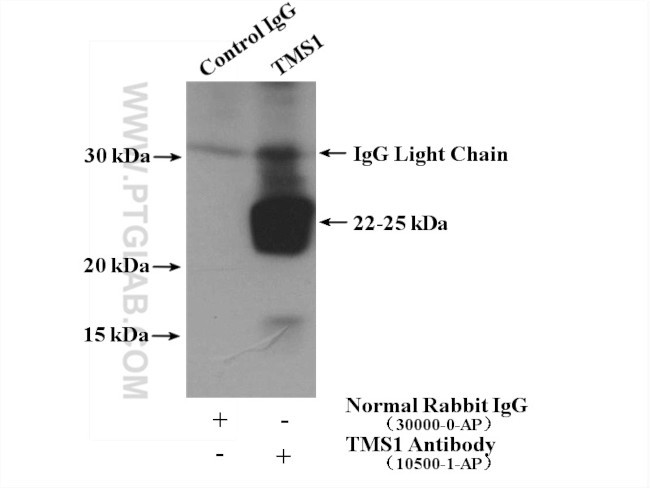 ASC/TMS1 Antibody in Immunoprecipitation (IP)