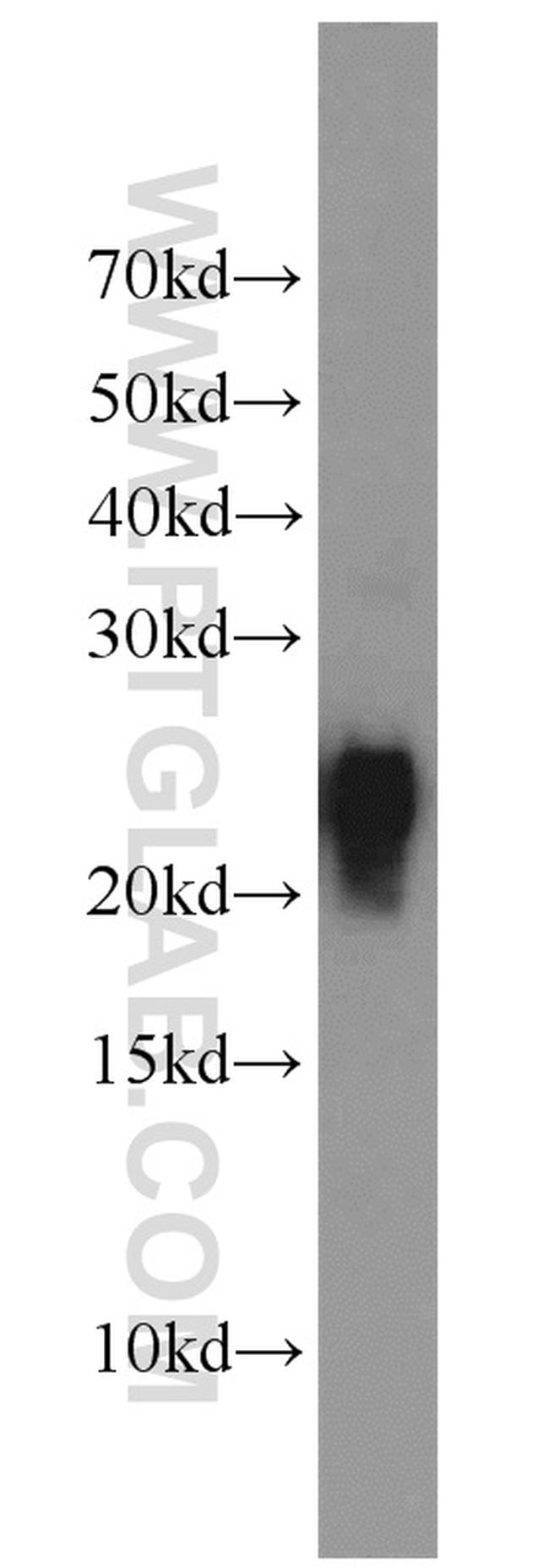 ASC/TMS1 Antibody in Western Blot (WB)