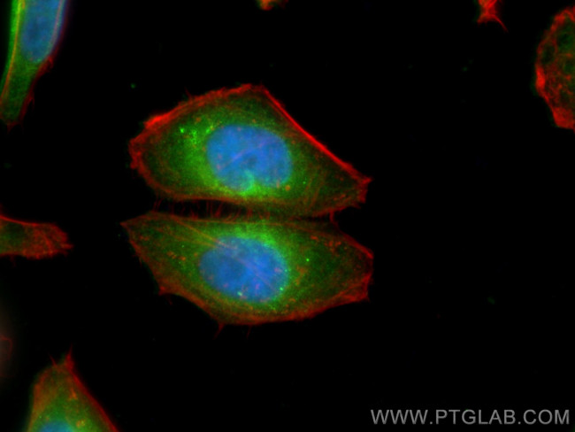 PSAT1 Antibody in Immunocytochemistry (ICC/IF)