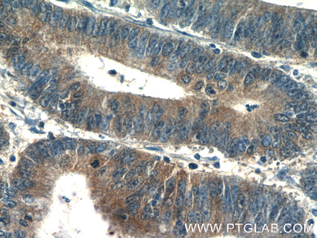 PSAT1 Antibody in Immunohistochemistry (Paraffin) (IHC (P))