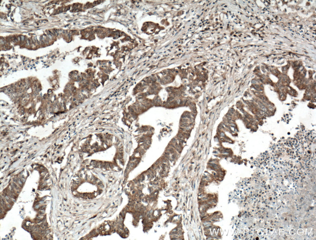 PSAT1 Antibody in Immunohistochemistry (Paraffin) (IHC (P))