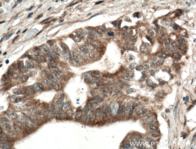 PSAT1 Antibody in Immunohistochemistry (Paraffin) (IHC (P))