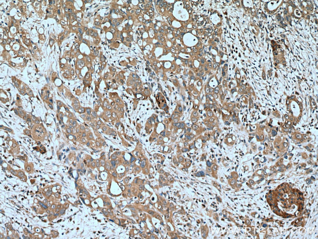 PSAT1 Antibody in Immunohistochemistry (Paraffin) (IHC (P))