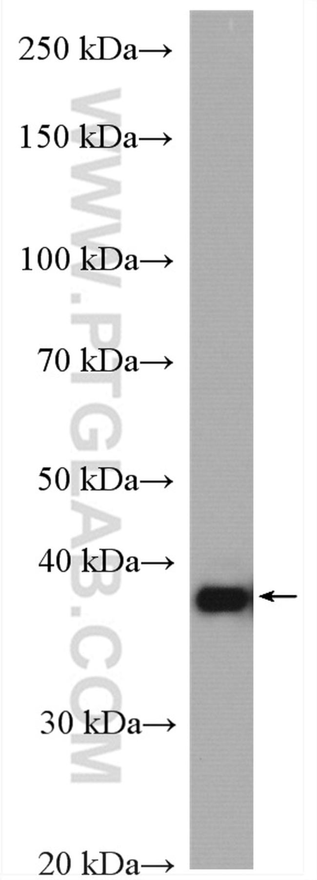 PSAT1 Antibody in Western Blot (WB)