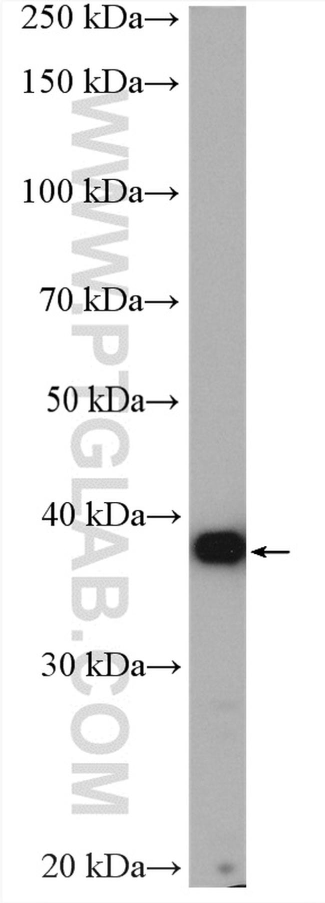 PSAT1 Antibody in Western Blot (WB)