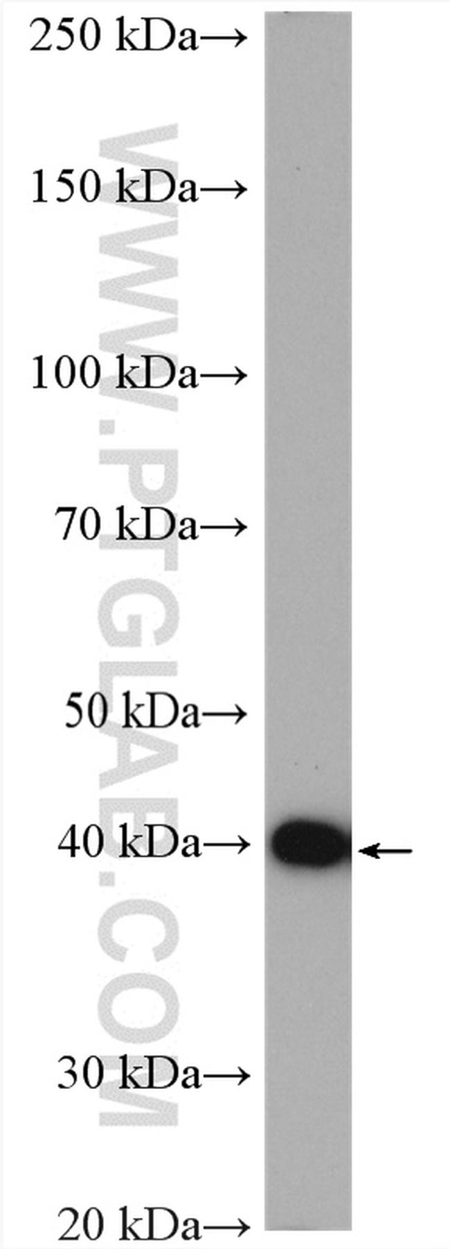 PSAT1 Antibody in Western Blot (WB)