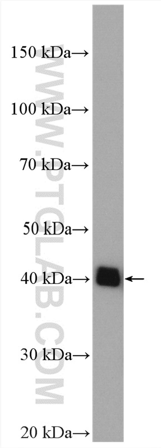 PSAT1 Antibody in Western Blot (WB)