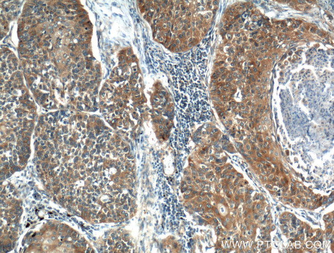 KEAP1 Antibody in Immunohistochemistry (Paraffin) (IHC (P))