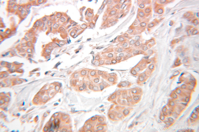 KEAP1 Antibody in Immunohistochemistry (Paraffin) (IHC (P))