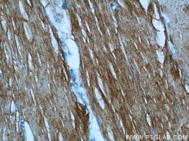 KEAP1 Antibody in Immunohistochemistry (Paraffin) (IHC (P))