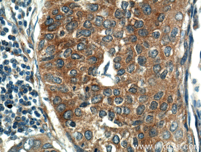 KEAP1 Antibody in Immunohistochemistry (Paraffin) (IHC (P))