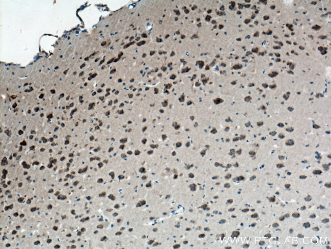 GSTA2 Antibody in Immunohistochemistry (Paraffin) (IHC (P))