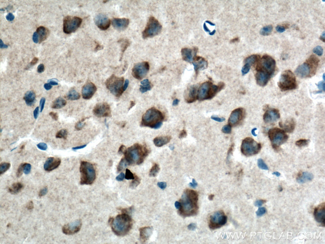 GSTA2 Antibody in Immunohistochemistry (Paraffin) (IHC (P))