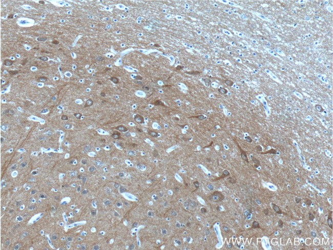 NCS1 Antibody in Immunohistochemistry (Paraffin) (IHC (P))