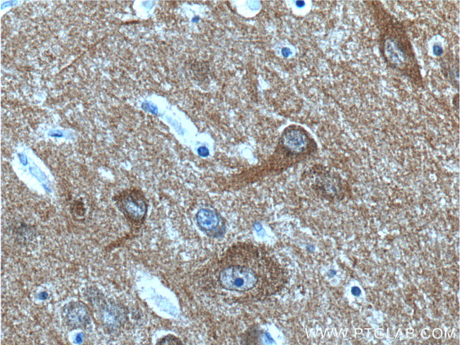 NCS1 Antibody in Immunohistochemistry (Paraffin) (IHC (P))