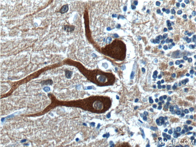 NCS1 Antibody in Immunohistochemistry (Paraffin) (IHC (P))