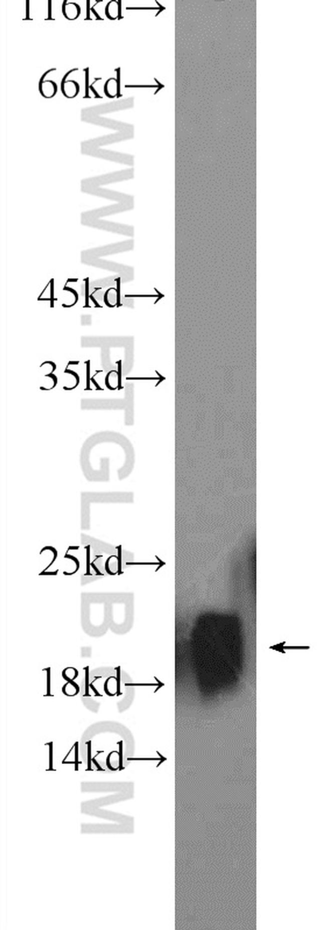 NCS1 Antibody in Western Blot (WB)