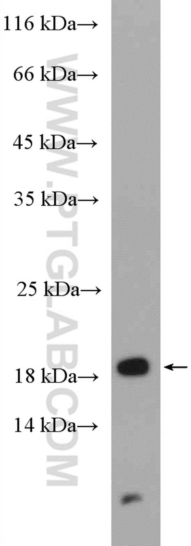 SURVIVIN Antibody in Western Blot (WB)