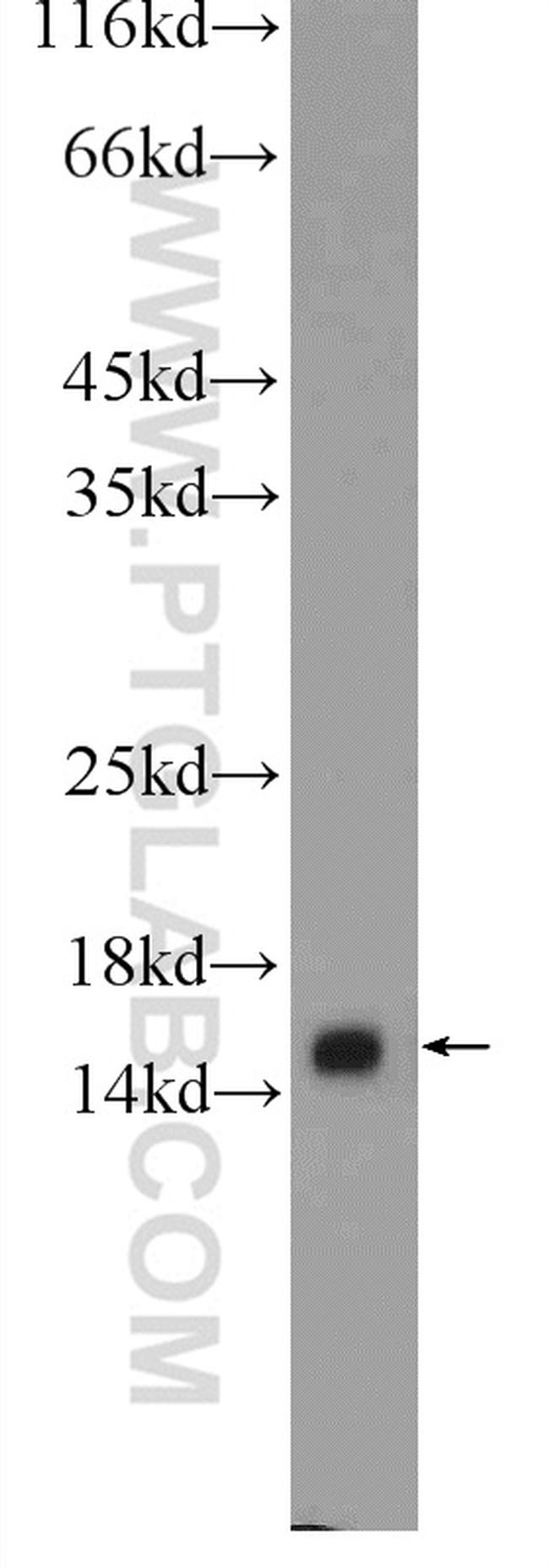 SURVIVIN Antibody in Western Blot (WB)