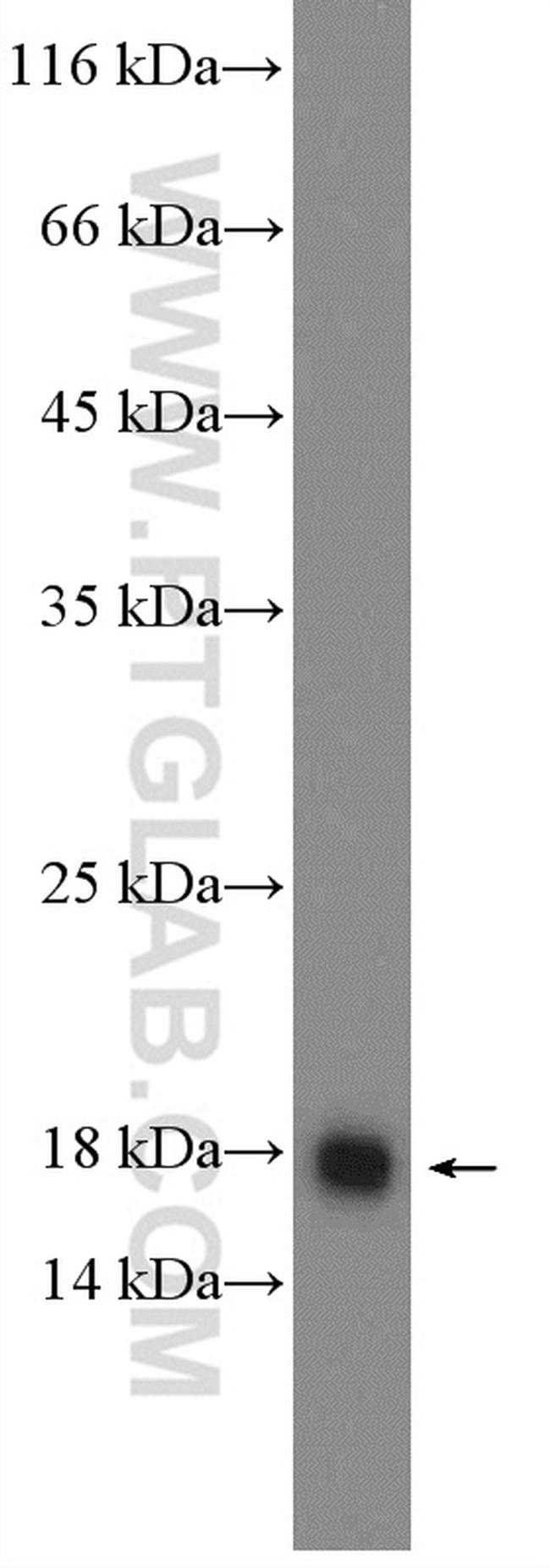 SURVIVIN Antibody in Western Blot (WB)