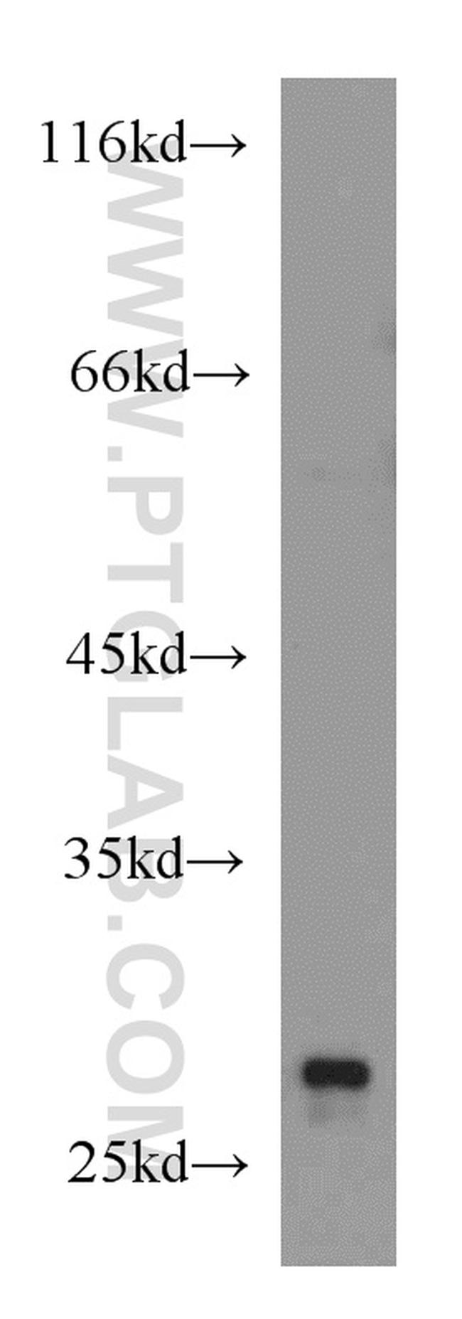 RhoGDI Antibody in Western Blot (WB)