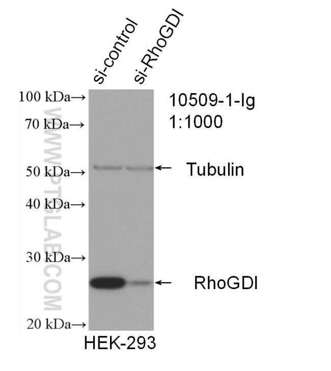 RhoGDI Antibody in Western Blot (WB)