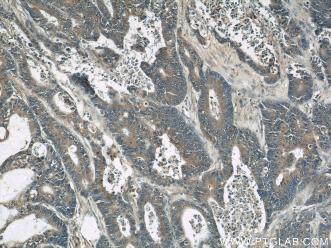 RhoGDI Antibody in Immunohistochemistry (Paraffin) (IHC (P))