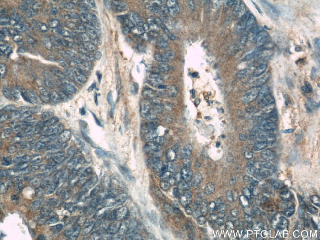 RhoGDI Antibody in Immunohistochemistry (Paraffin) (IHC (P))