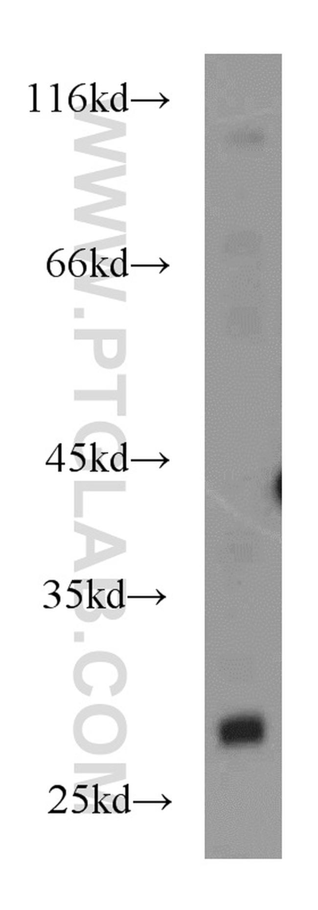 RhoGDI Antibody in Western Blot (WB)