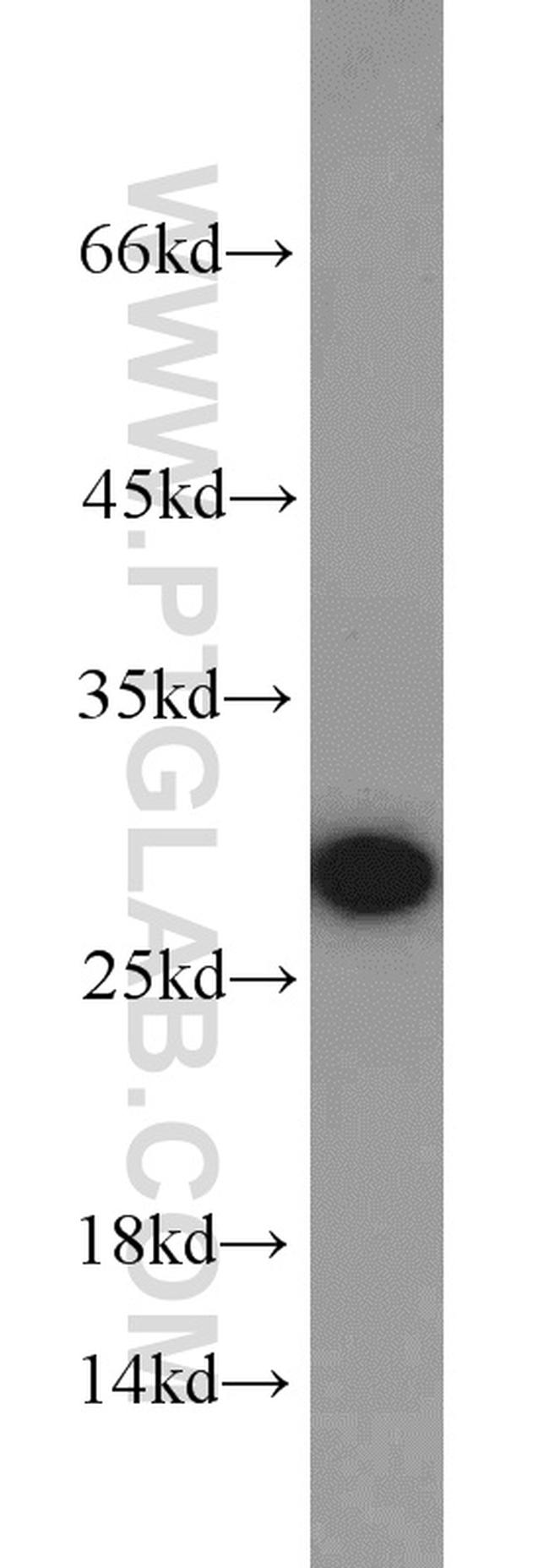 RhoGDI Antibody in Western Blot (WB)