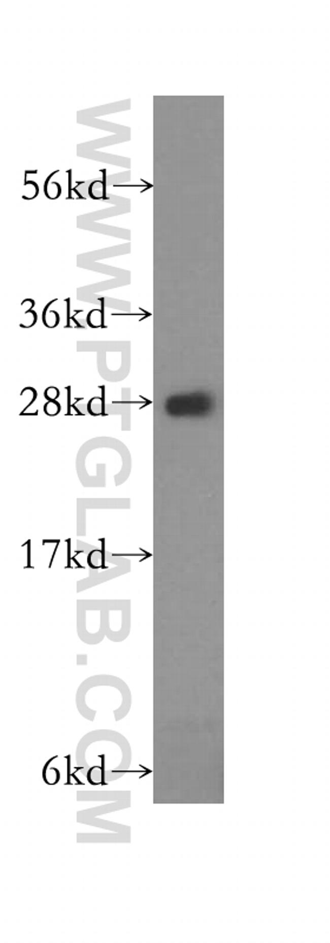 RhoGDI Antibody in Western Blot (WB)