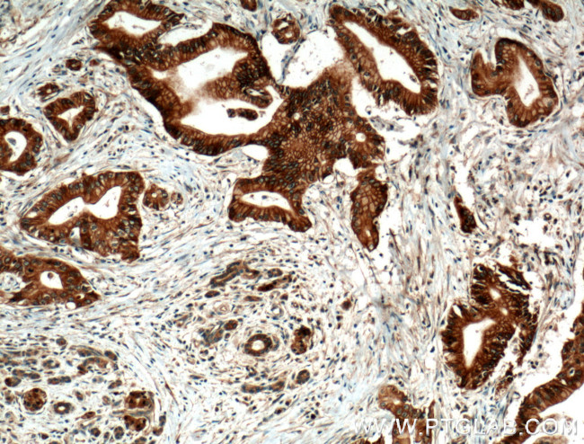 BLK Antibody in Immunohistochemistry (Paraffin) (IHC (P))