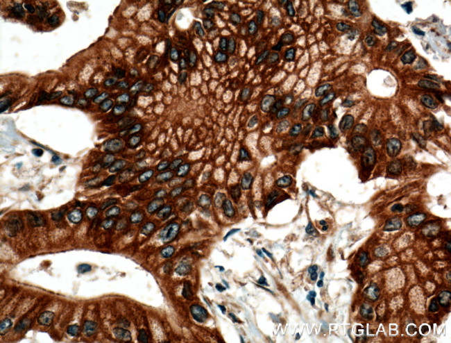 BLK Antibody in Immunohistochemistry (Paraffin) (IHC (P))