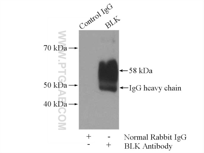 BLK Antibody in Immunoprecipitation (IP)
