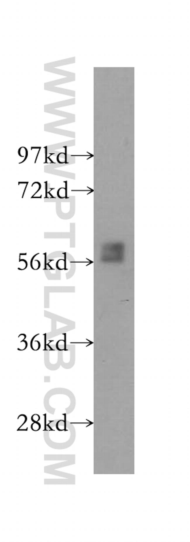 BLK Antibody in Western Blot (WB)