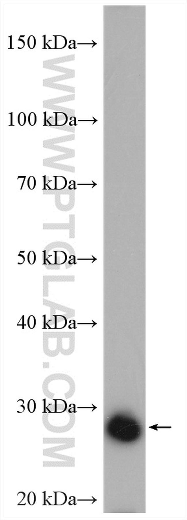 UCK2 Antibody in Western Blot (WB)