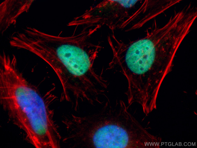 MCM2 Antibody in Immunocytochemistry (ICC/IF)