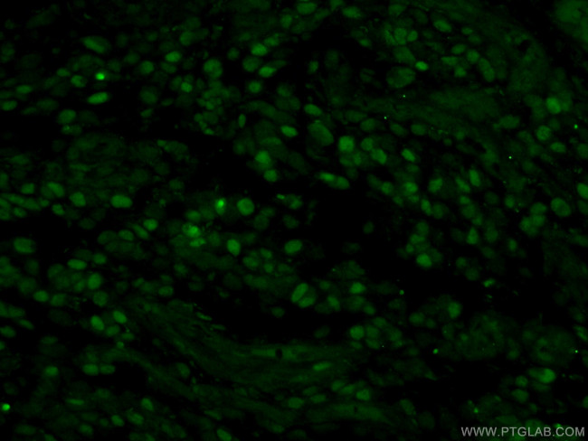 MCM2 Antibody in Immunohistochemistry (PFA fixed) (IHC (PFA))