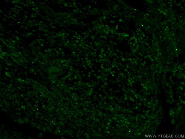 MCM2 Antibody in Immunohistochemistry (PFA fixed) (IHC (PFA))