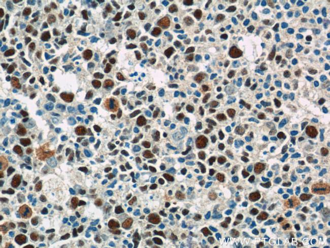 MCM2 Antibody in Immunohistochemistry (Paraffin) (IHC (P))